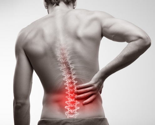 The Basics of Telespine